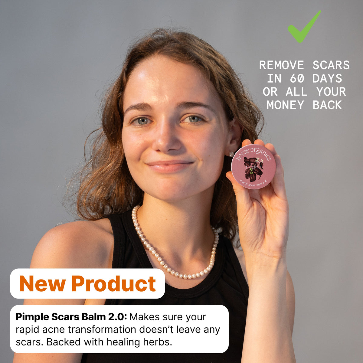 Pimple Scars Balm 2.0