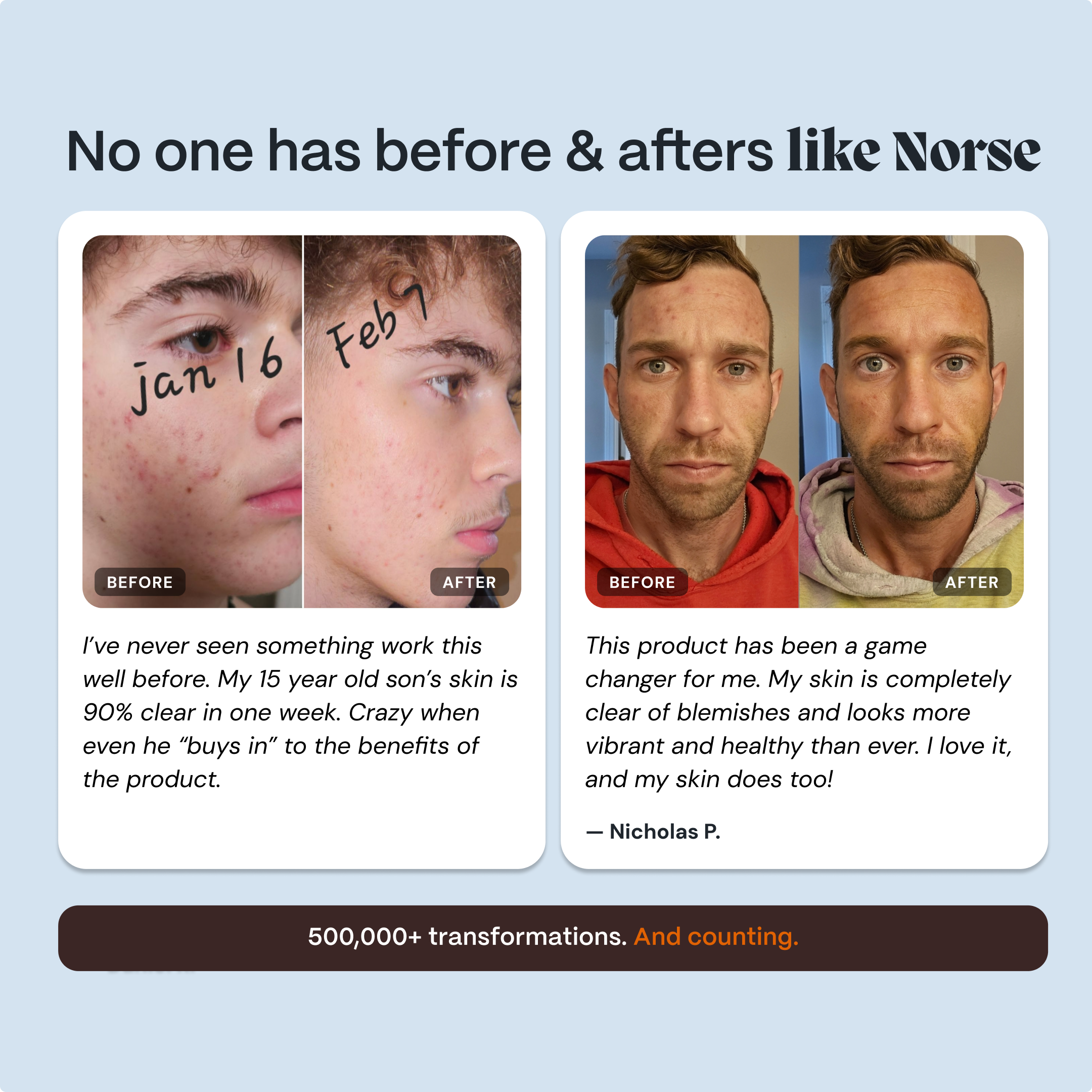 Complete Gut Repair & Hormonal Balance System for Male Acne