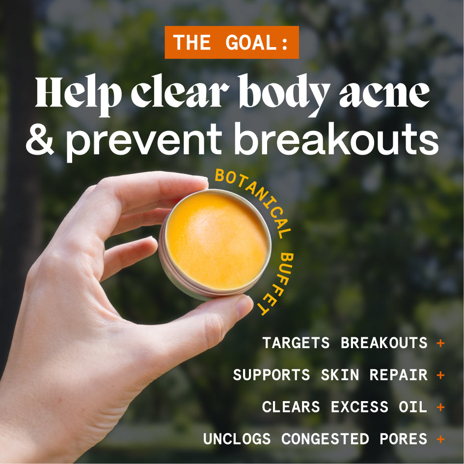 Body Balm for Acne Prone Skin