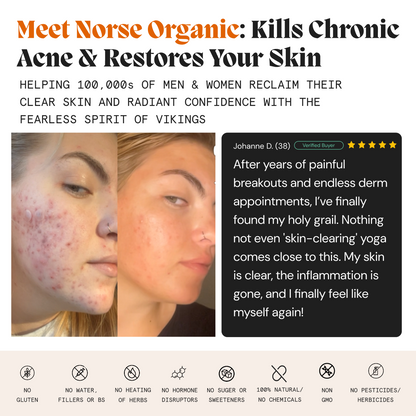 Complete Gut Repair & Hormonal Balance System for Female Acne