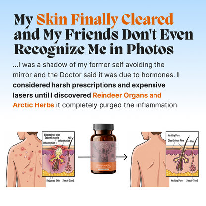 Complete Gut Repair & Hormonal Balance System for Female Acne