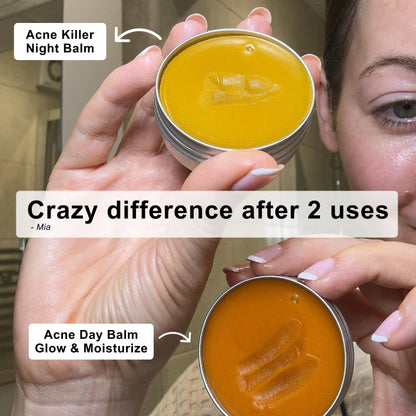 The Complete Acne Killer System 2.0